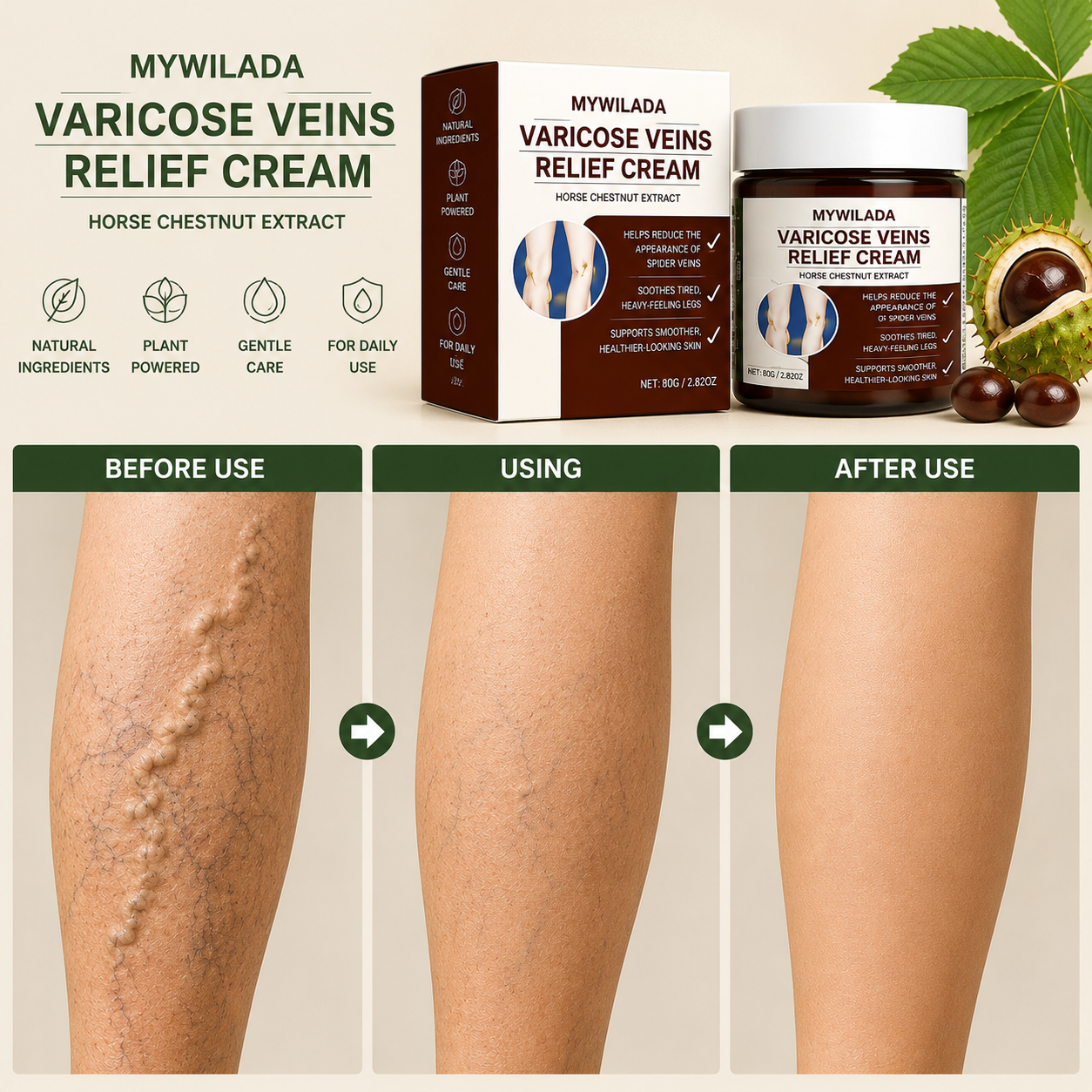 VeinEase™ Varicose Vein Relief Cream