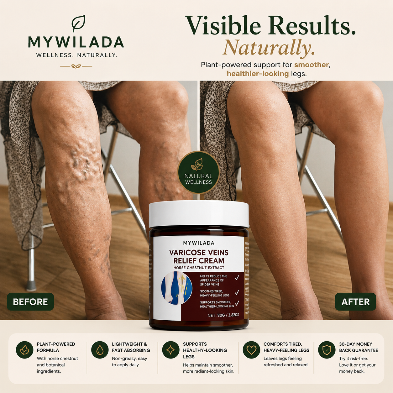 VeinEase™ Varicose Vein Relief Cream